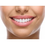 Igiene Orale Cure Dentarie dei Denti Shop Online Svizzera CH